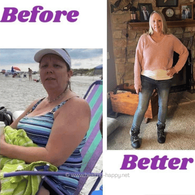 My Before and After Pics