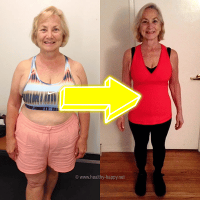 My Before and After Pics