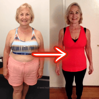 My Before and After Pics