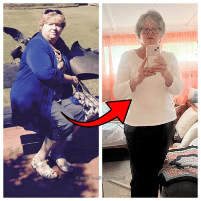 My Before and After Pics