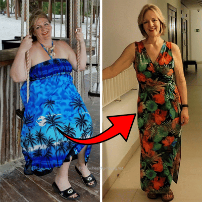 My Before and After Pics